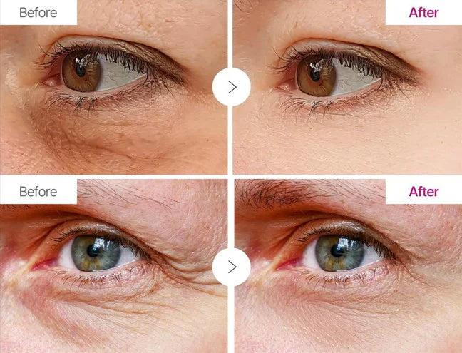 Yunée Calcium Volume Multi-Balm